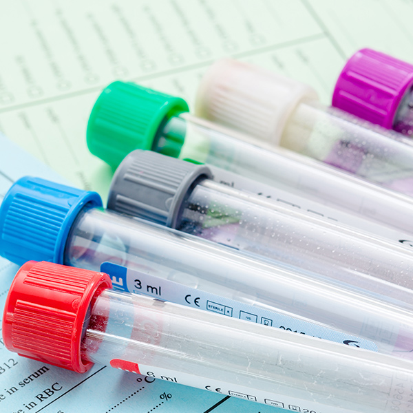 lab-tests.jpg